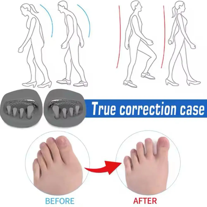 Leg Correction Slippers Scient - Home Improvement Man 评论和价格